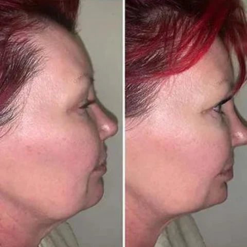 Masajeador Reductor y Rejuvenecedor Facial - RenovaSkin Pro