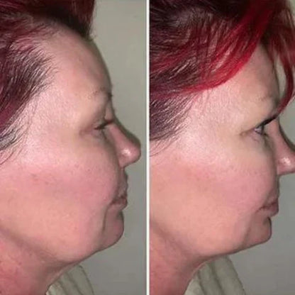 Masajeador Reductor y Rejuvenecedor Facial - RenovaSkin Pro